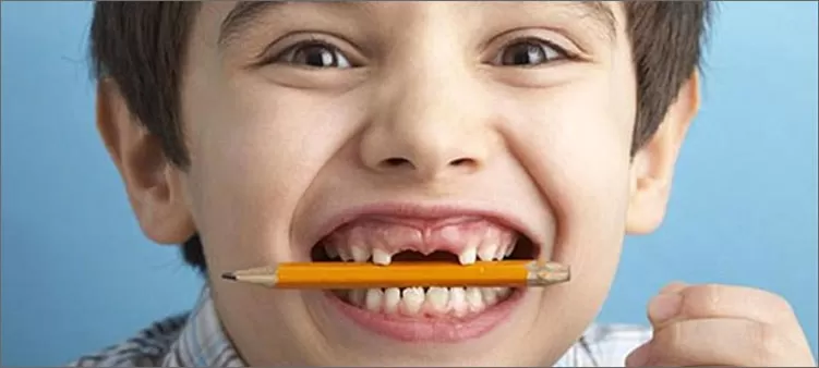Причина стирания зубов - Привычка держать что-то во рту или грызть что-то зубами